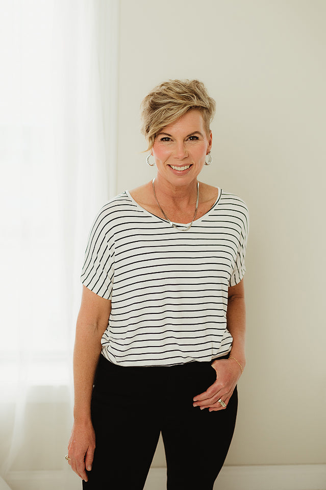Striped Casual Tunic